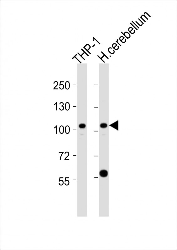 1 - ZFPM1 Antibody (C-term) AP21263b