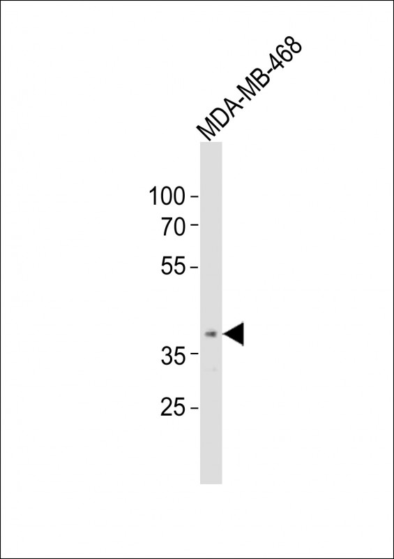1 - OR5A1 Antibody (C-term) AP21280b