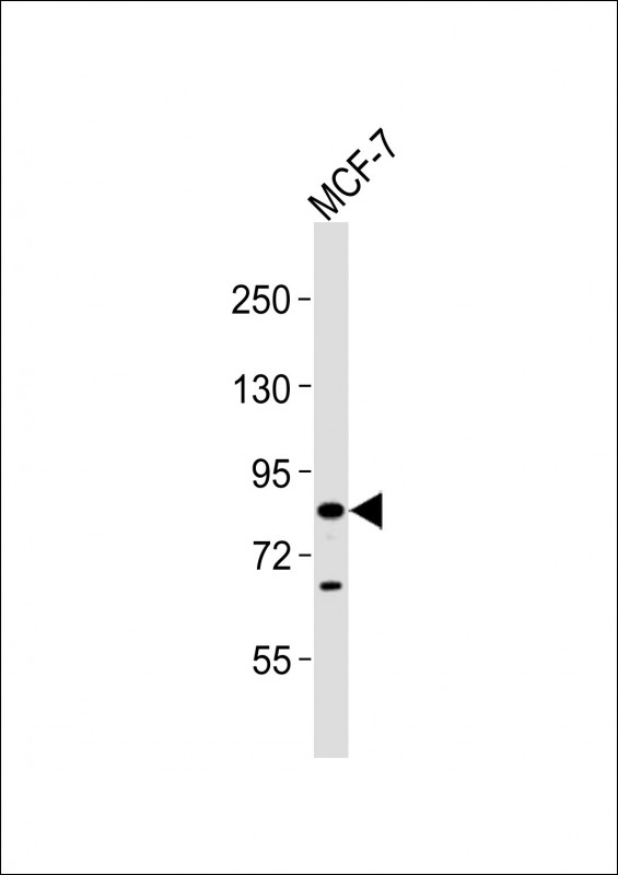 1 - SEMA3E Antibody AP21300a