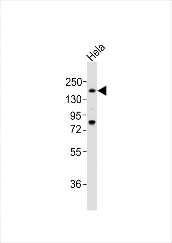 1 - LAMA4 Antibody (C-term) AP21315b