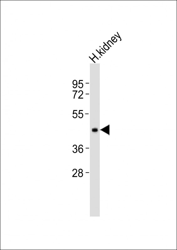 1 - INPP5A Antibody (C-term) AP21321b