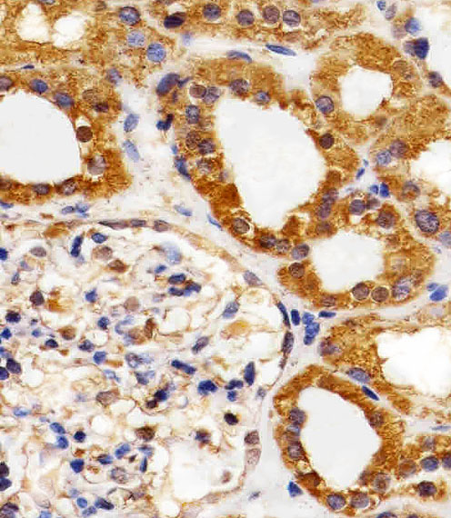 14 - VEGFR3 Antibody AW5293
