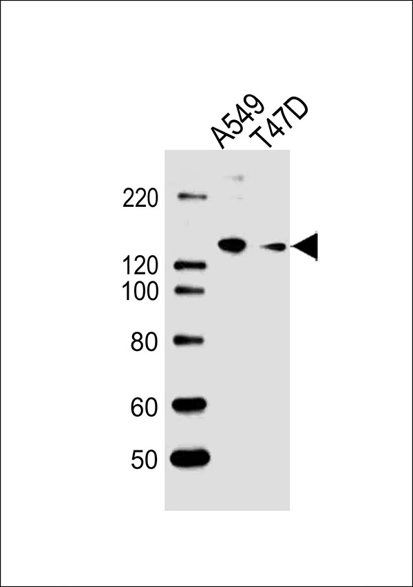 1 - VEGFR3 Antibody AW5293