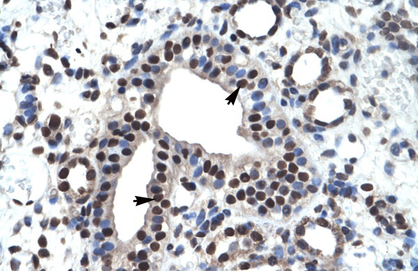 2 - ZNF499 antibody - middle region AI10159