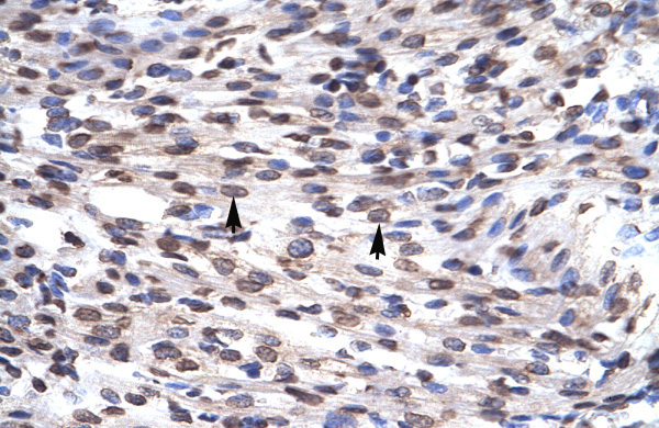 2 - GFI1B antibody - N-terminal region AI10168
