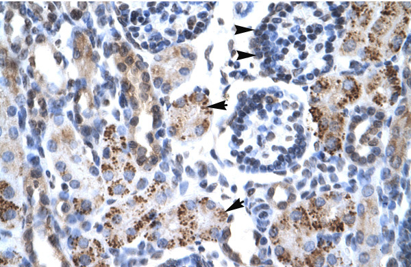 2 - GFI1B antibody - N-terminal region AI10168