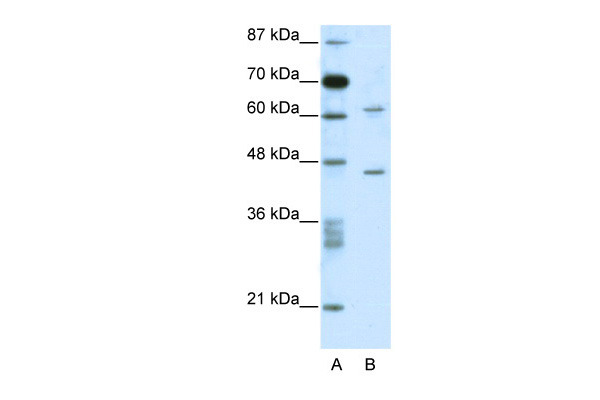 1 - C1ORF25 antibody - N-terminal region AI10171