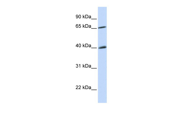 1 - CHEK2 antibody - N-terminal region AI10177