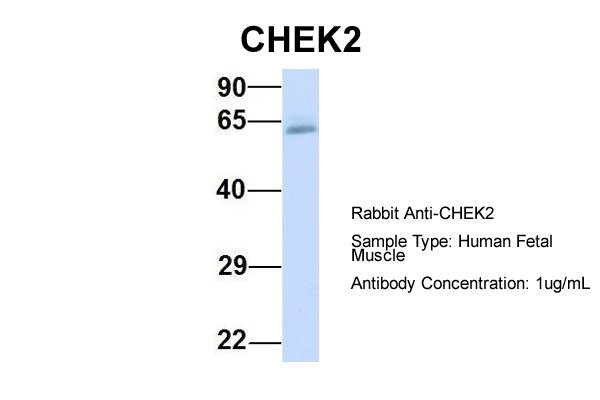 1 - CHEK2 antibody - N-terminal region AI10177