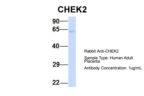 1 - CHEK2 antibody - N-terminal region AI10177