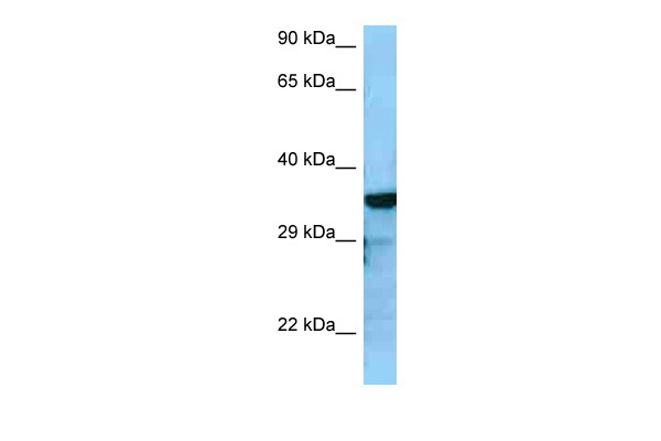 1 - RGS4 antibody - C-terminal region AI10178