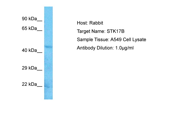 1 - STK17B Antibody - C-terminal region AI10182