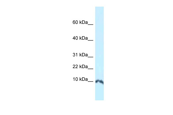 1 - Sumo1 antibody - N-terminal region AI10187