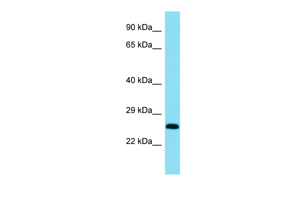 1 - Bcl11a Antibody - C-terminal region AI10199