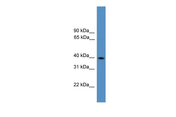 1 - Pax2 antibody - middle region AI10213