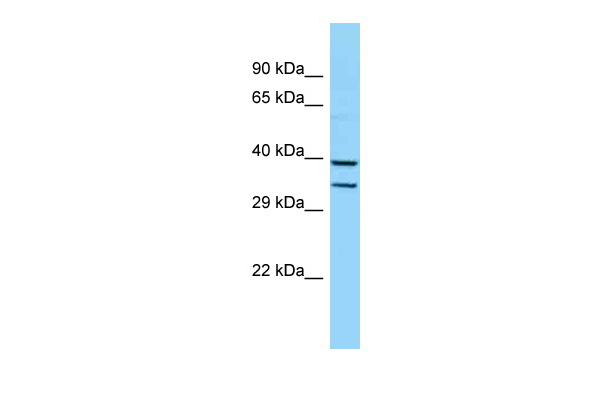 1 - Hoxb5 antibody - middle region AI10230