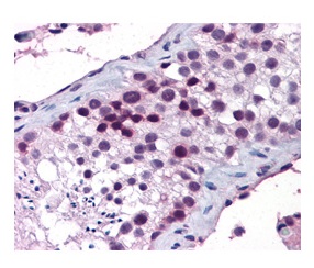 2 - HOXA5 antibody - middle region AI10231