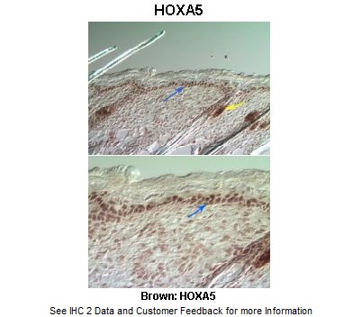 2 - HOXA5 antibody - middle region AI10231