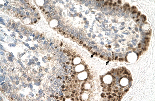 2 - ZFP1 antibody - N-terminal region AI10246