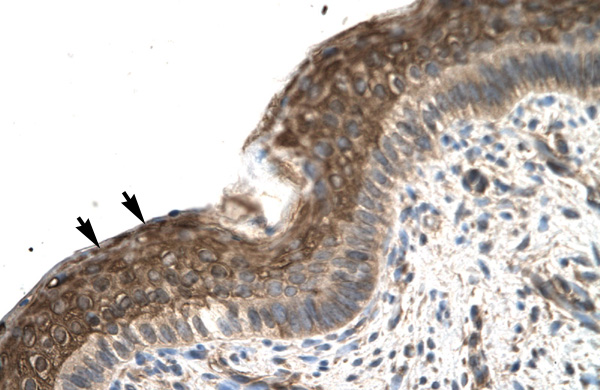 2 - ZFP1 antibody - N-terminal region AI10246