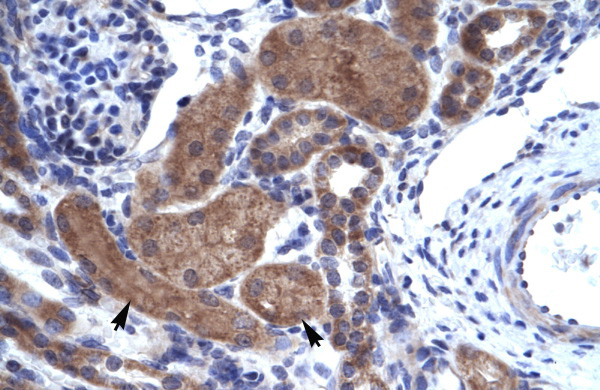 2 - ZNFN1A2 antibody - C-terminal region AI10259