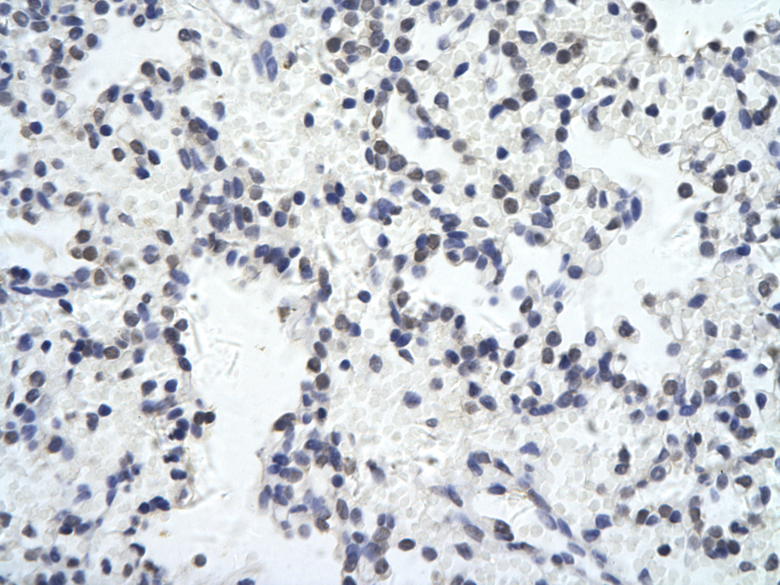 2 - ZNF652 antibody - N-terminal region AI10260