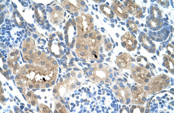 2 - TLR6 antibody - middle region AI10269
