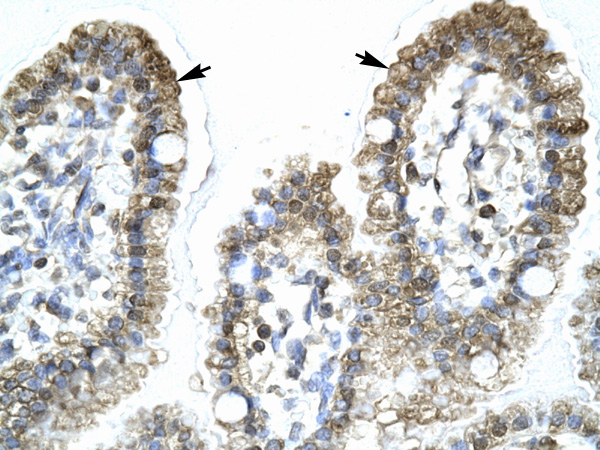 2 - MYCBP antibody - middle region AI10281