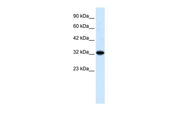 1 - ZBTB32 antibody - N-terminal region AI10282