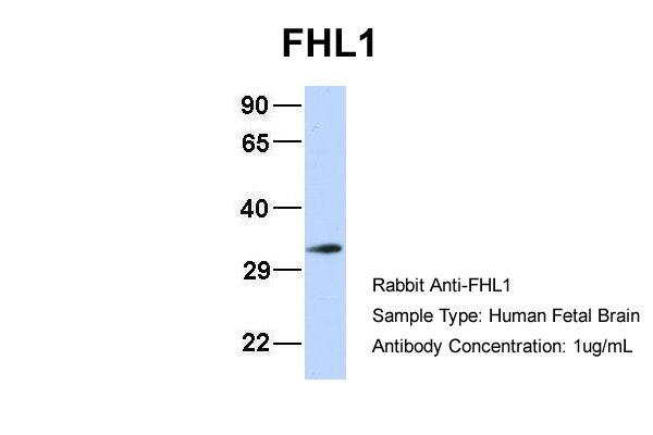 1 - FHL1 antibody - N-terminal region AI10285