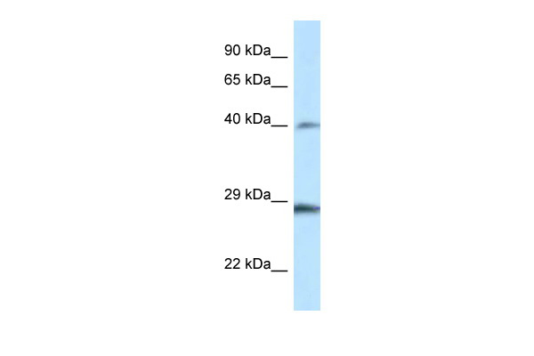 1 - Hoxb9 antibody - middle region AI10291