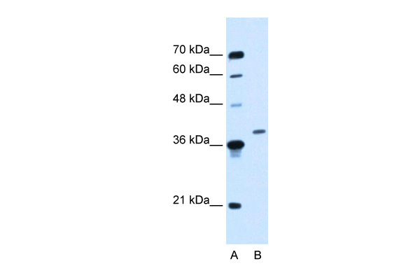 1 - HOXD11 antibody - middle region AI10292