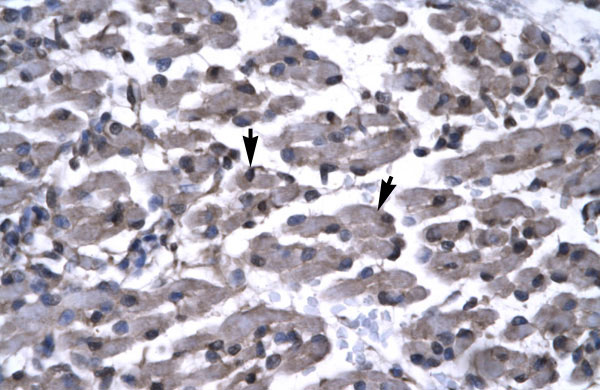 2 - PAWR antibody - middle region AI10306