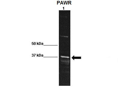 1 - PAWR antibody - middle region AI10306