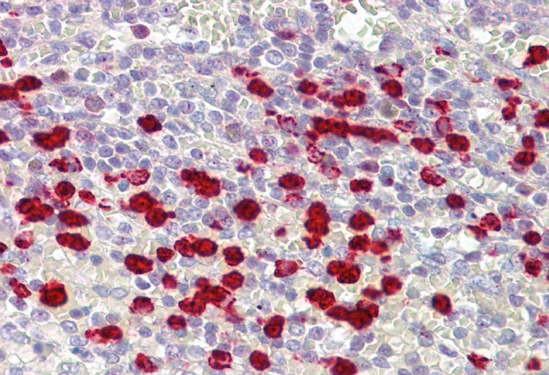2 - ZNF746 antibody - middle region AI10321