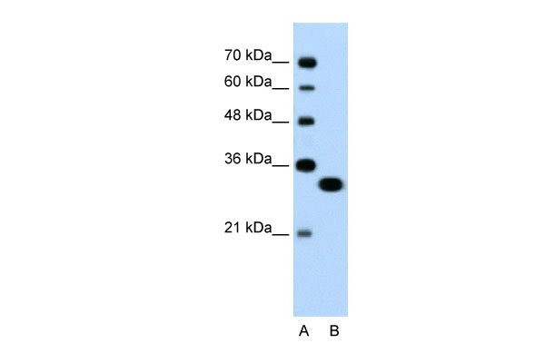 1 - TFEC antibody - N-terminal region AI10333