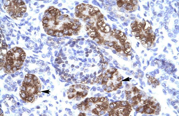 2 - ZNF409 antibody - middle region AI10334