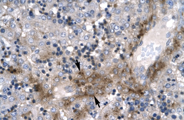 2 - ZNF365 antibody - N-terminal region AI10337
