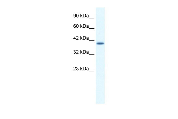 1 - ZNF365 antibody - N-terminal region AI10337