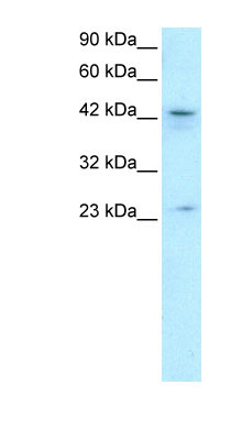 1 - ZNF365 antibody - N-terminal region AI10337