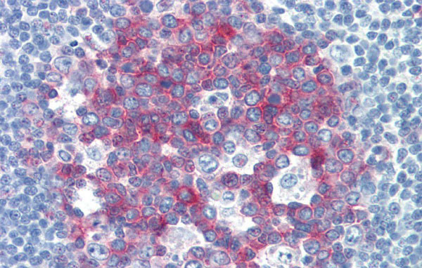 2 - NCOA3 antibody - middle region AI10369