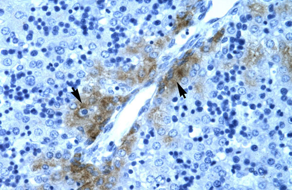 2 - GATA3 antibody - C-terminal region AI10380