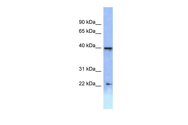 1 - HOXA2 antibody - C-terminal region AI10394