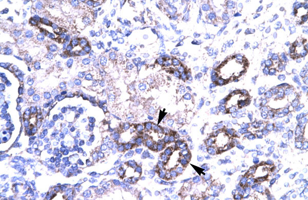 2 - PAWR antibody - middle region AI10411