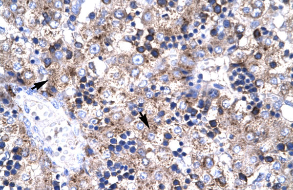2 - PAWR antibody - middle region AI10411