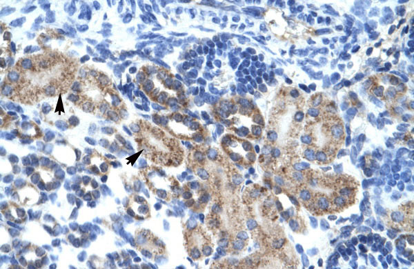 2 - CGI-62 antibody - C-terminal region AI10414