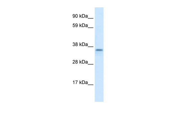 1 - CGI-62 antibody - C-terminal region AI10414