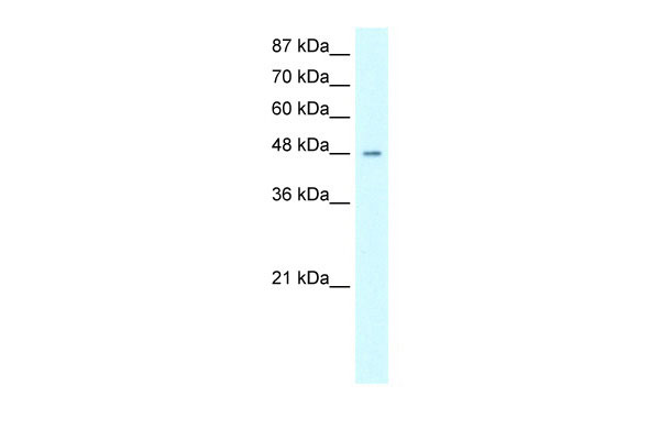 1 - HMG20A antibody - middle region AI10415