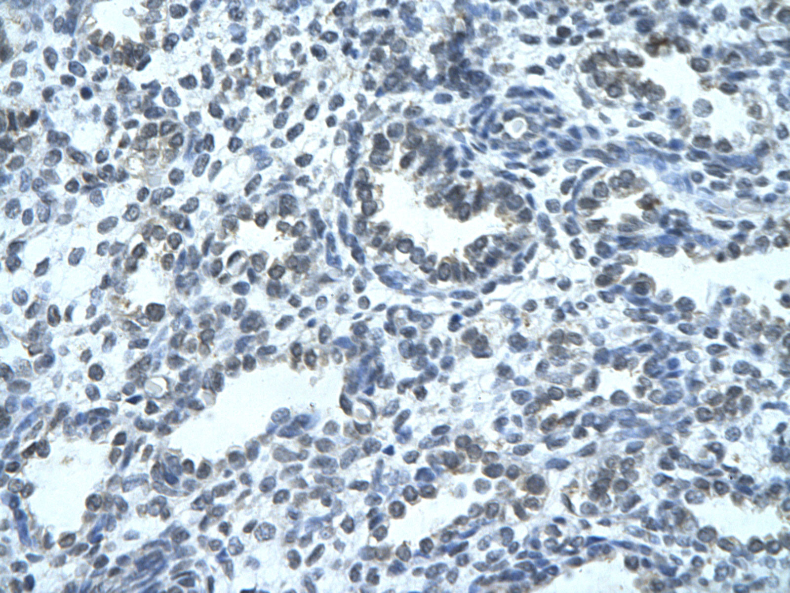 2 - ZNFN1A4 antibody - N-terminal region AI10485