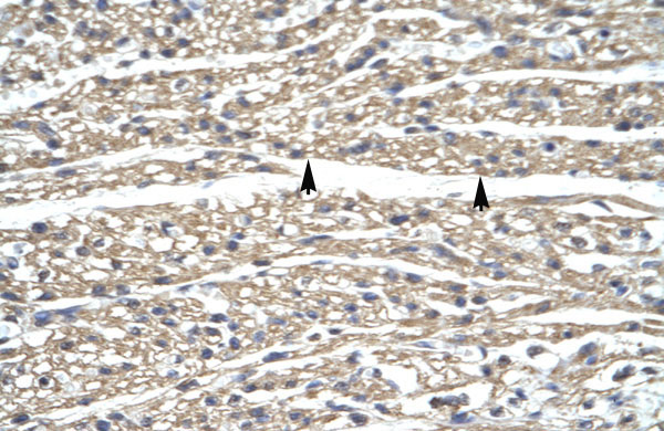 2 - ZNF336 antibody - N-terminal region AI10487